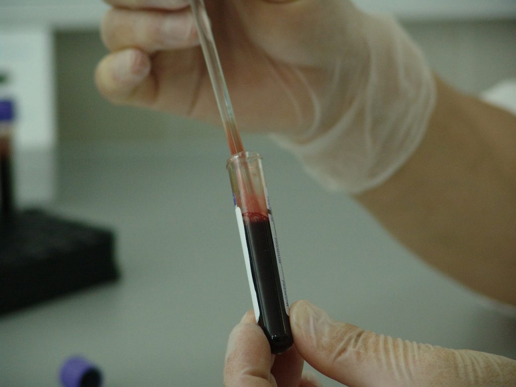blood-20745_1280